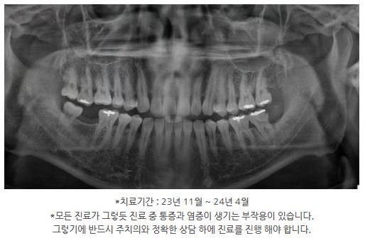 오늘바로플란트치과의원 이미지