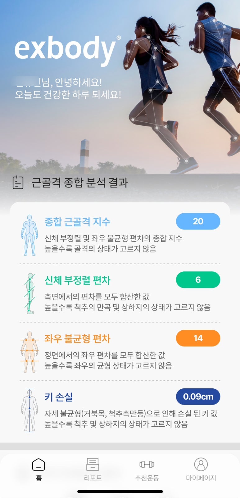 엑스바디 이미지