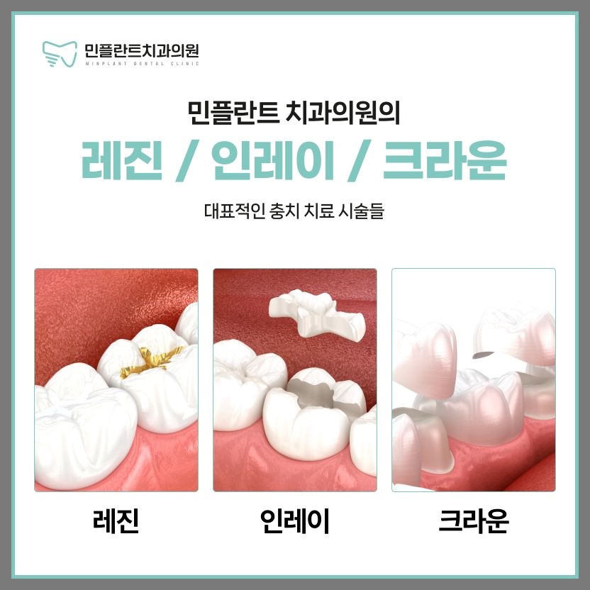 민플란트치과의원 이미지