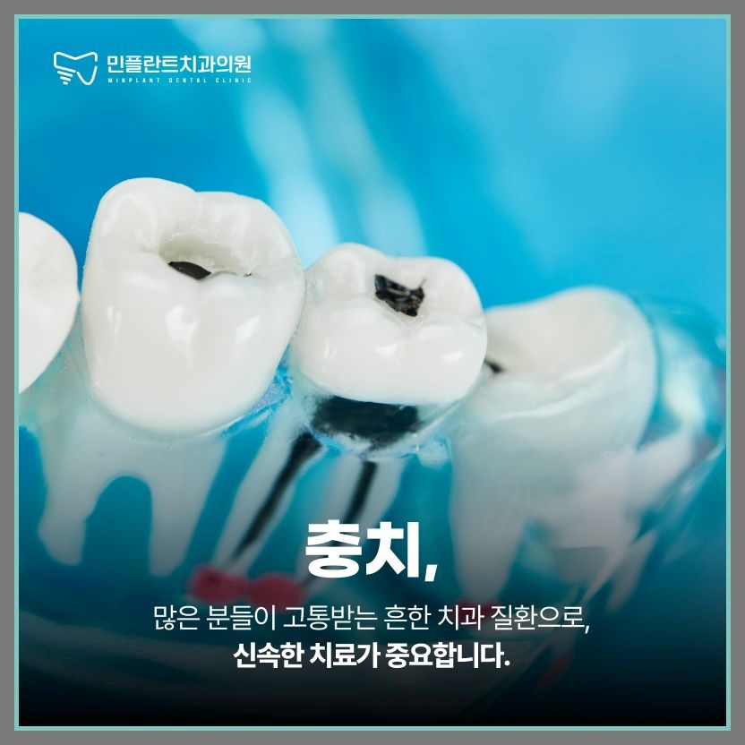 민플란트치과의원 이미지