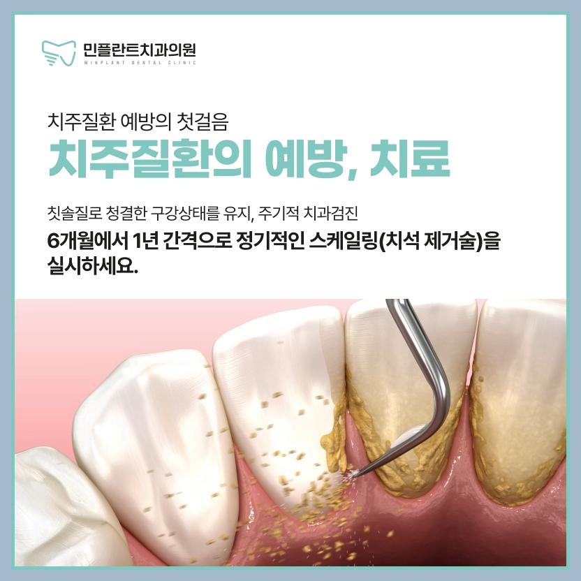 민플란트치과의원 이미지