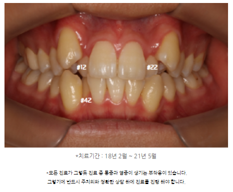 이탑치과 이미지