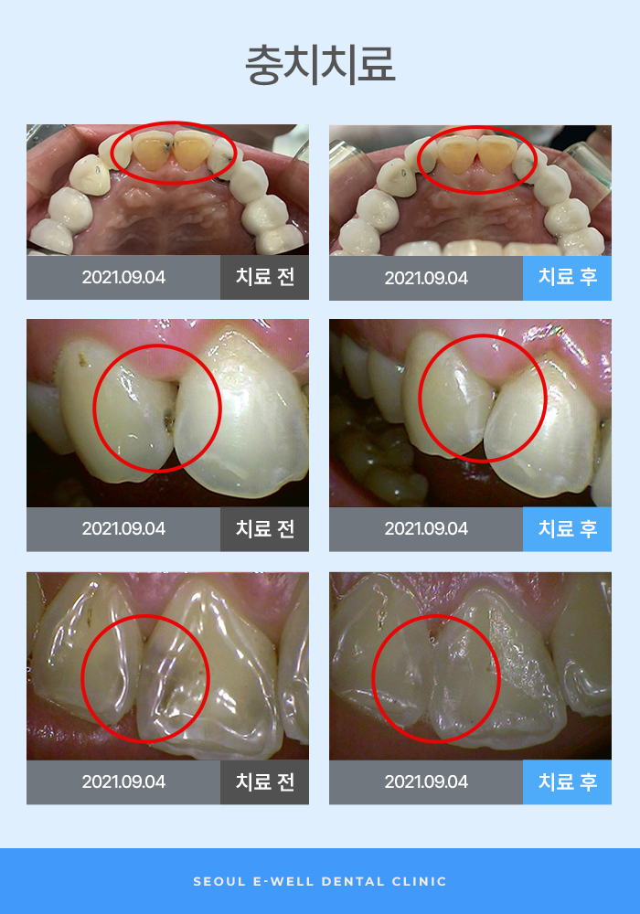 가까운치과 이미지