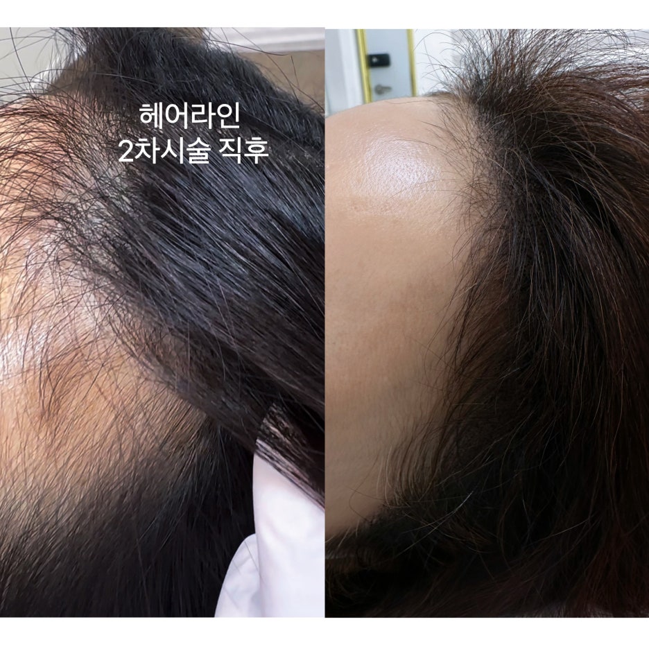 수기헤어 이미지
