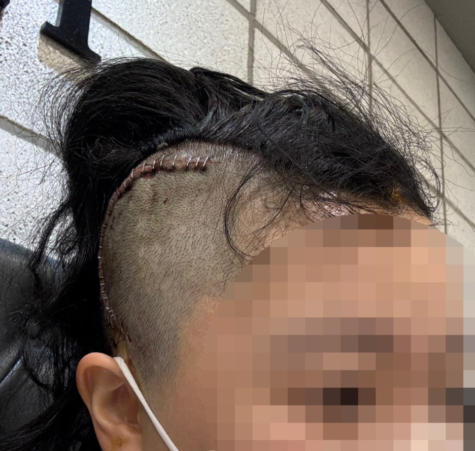 셀레브헤어 이미지