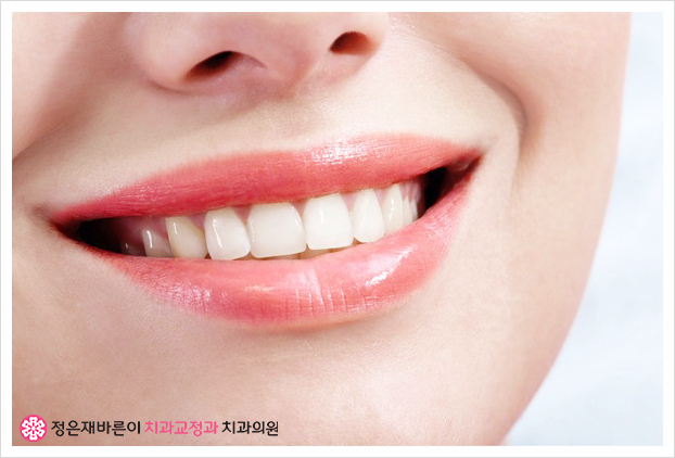미소짓는치과의원 이미지
