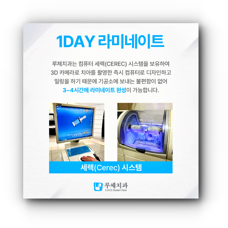 루체치과의원 이미지