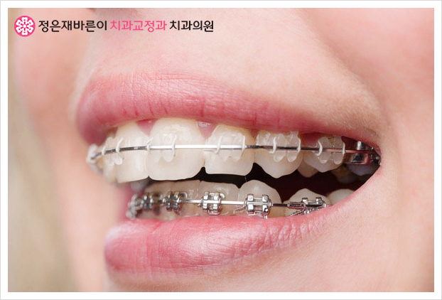미소하나치과교정과치과의원 이미지