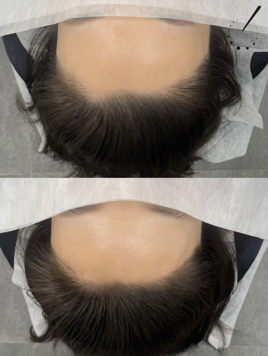 코라인 헤어 이미지