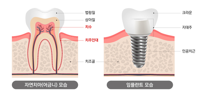 서울더편한치과의원 이미지