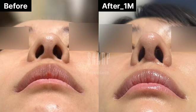 조각성형외과의원 이미지