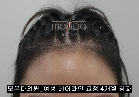 모우헤어 이미지