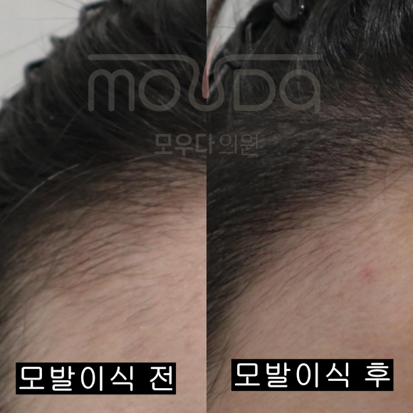 모우헤어 이미지