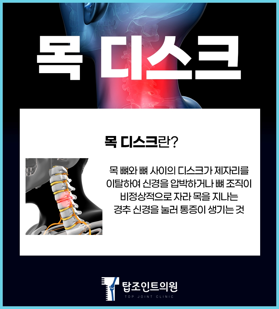 탑조인트의원 이미지