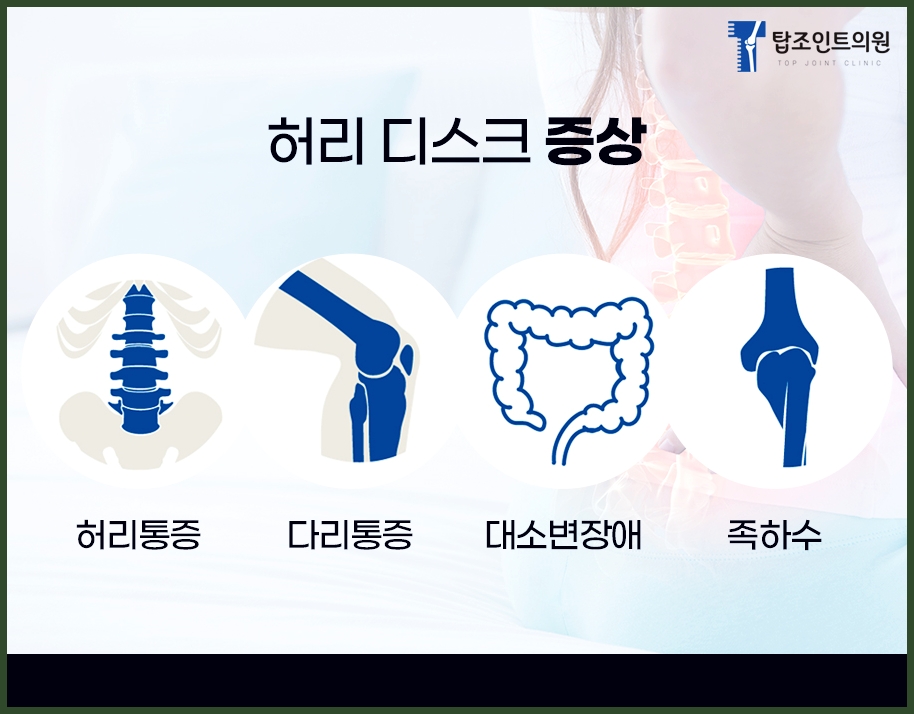 탑조인트의원 이미지