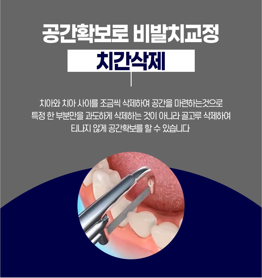 성남치과의원 이미지