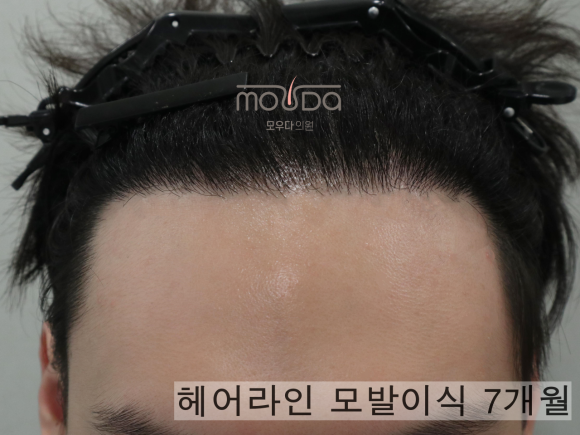 모우헤어 이미지