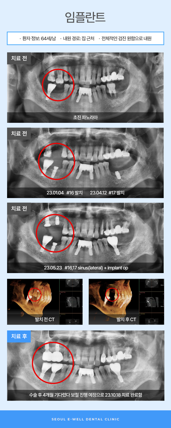 이수자연치과 이미지