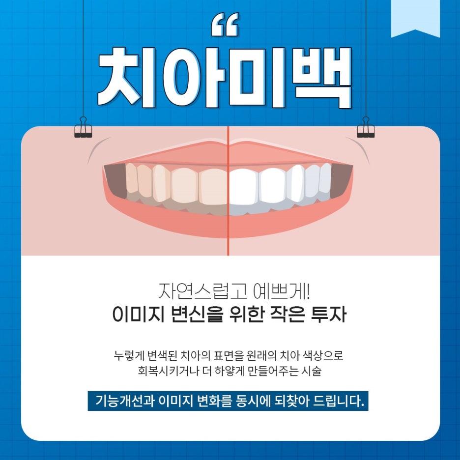 하얀미소치과의원 이미지