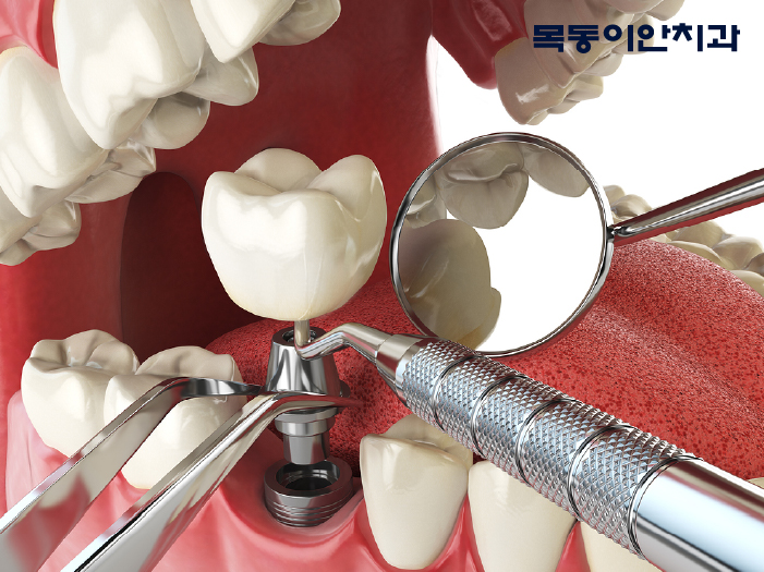 서울이안치과 이미지