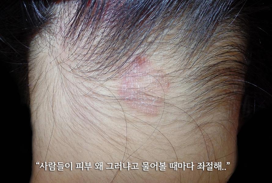 오던모발 이미지