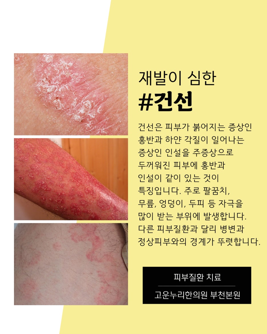 고운누리 이미지