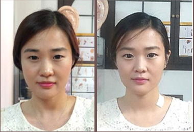 본뷰티 이미지