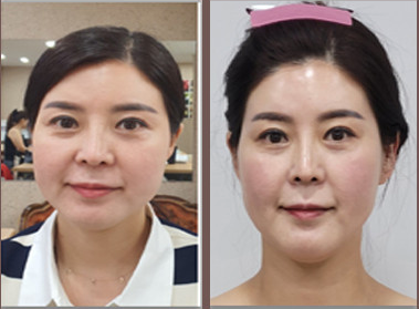 본뷰티 이미지