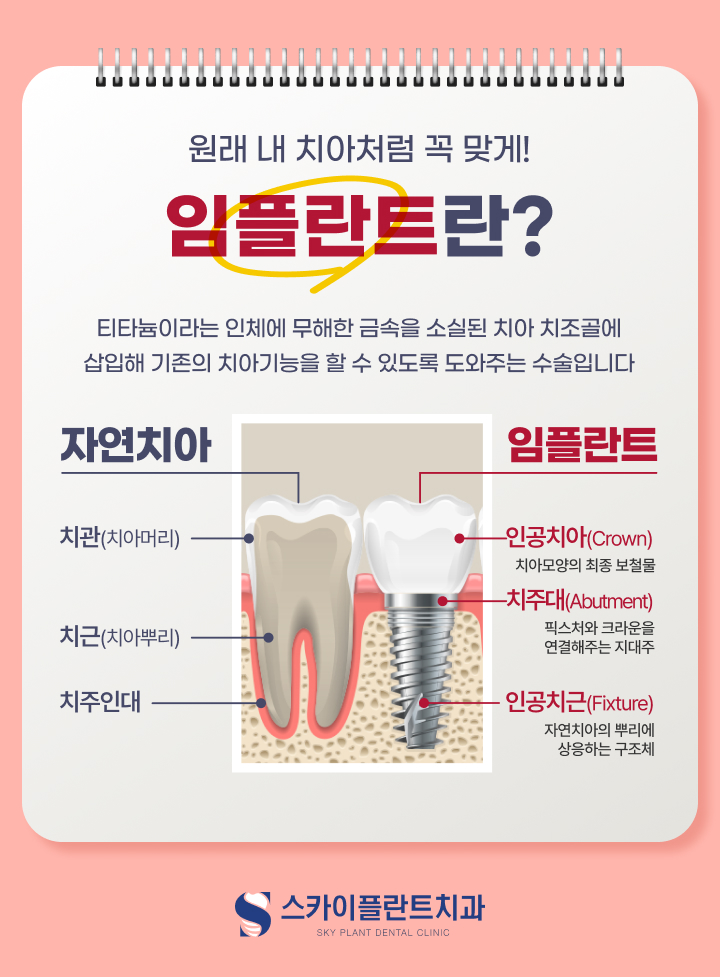 100세치과 이미지