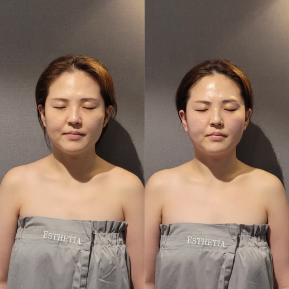 성신피부관리 이미지