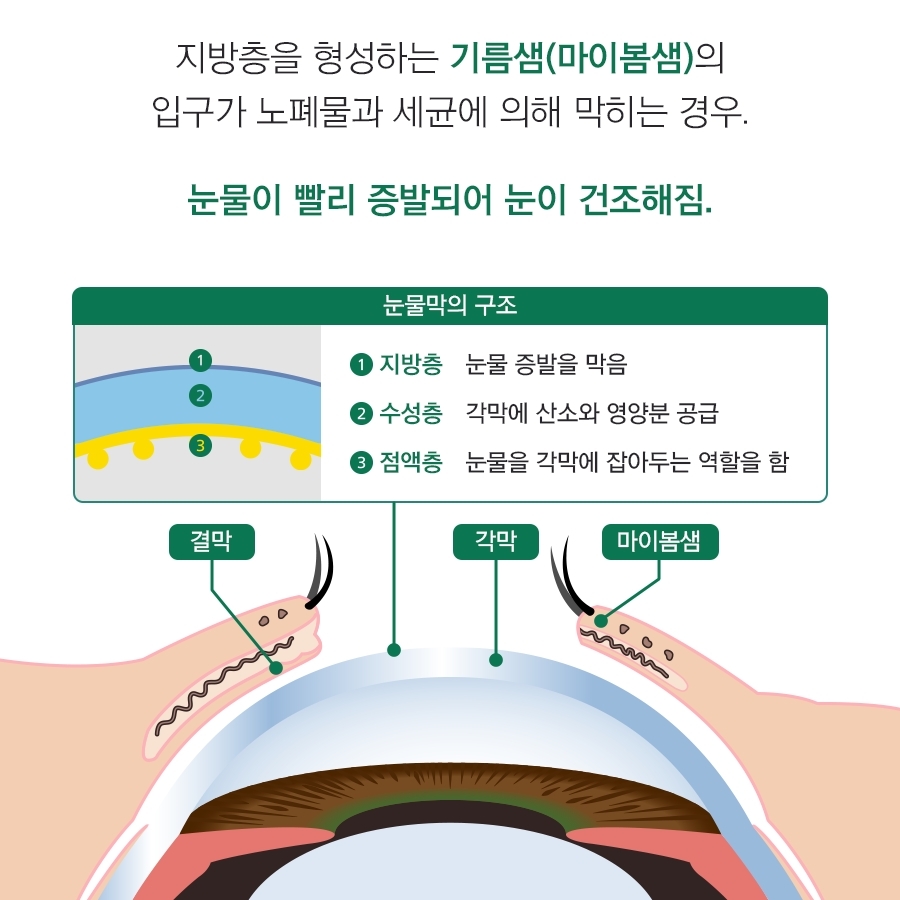 로운안과의원 이미지