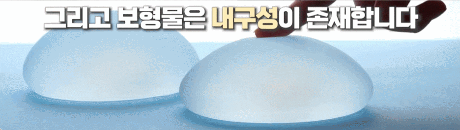 image4 가슴 보형물 수술 후, 왜 SVF가슴성형으로 재수술할까?