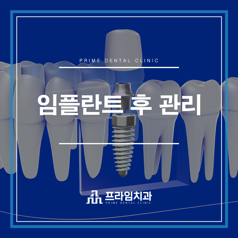 최소침습 임플란트