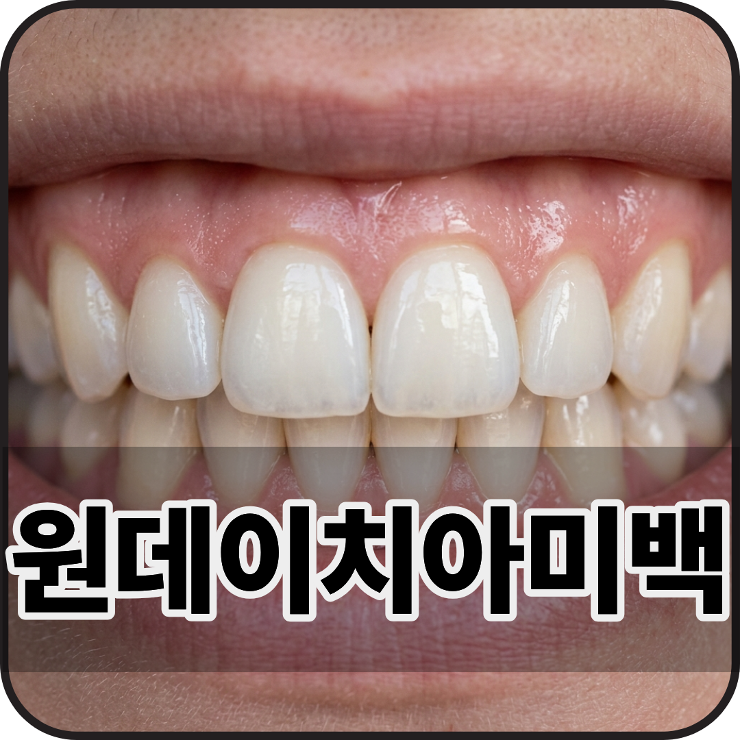 잠실 원데이 치아미백