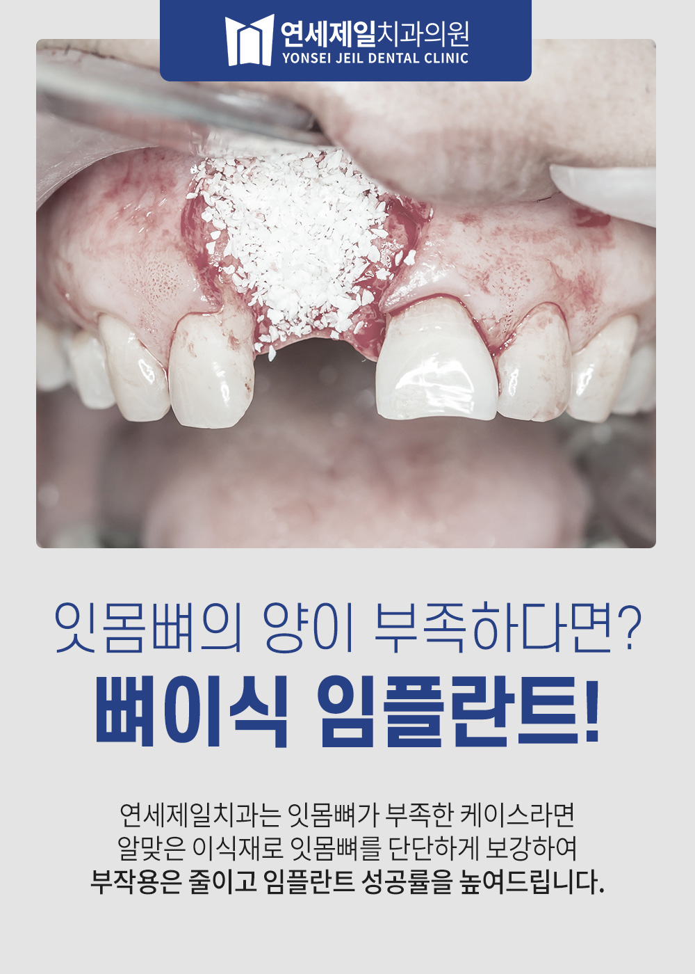 연세제일치과 8