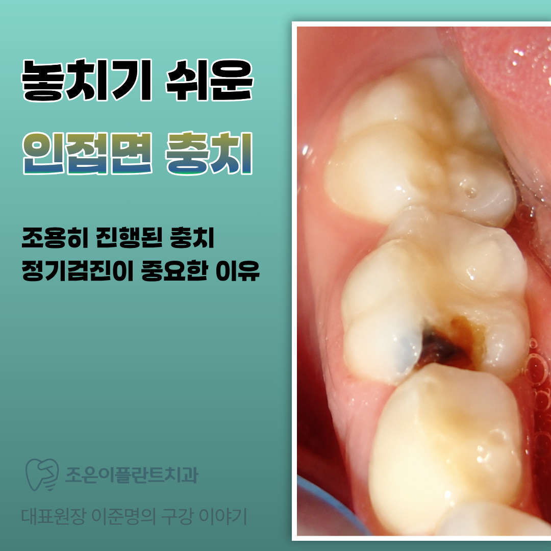 속초조은이플란트치과의원 8