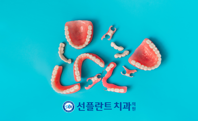 김량장동치과-용인선플란트치과-임시틀니사진