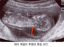 박산부인과 이미지