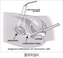 박산부인과 이미지